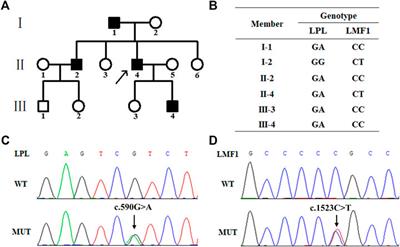 A Heterozygous LMF1 Gene Mutation (c.1523C>T), Combined With an LPL Gene Mutation (c.590G>A), Aggravates the Clinical Symptoms in Hypertriglyceridemia